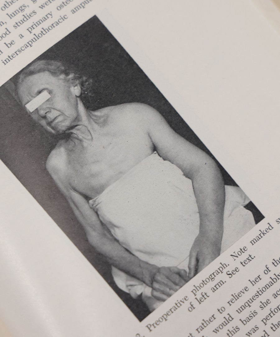 Lot 110 - "The Surgical Clinics Of North America, June 1947, Tumors" Vintage Medical Book With Photographs Of Pathology, W.B. Sauders Company Publishers, 1947