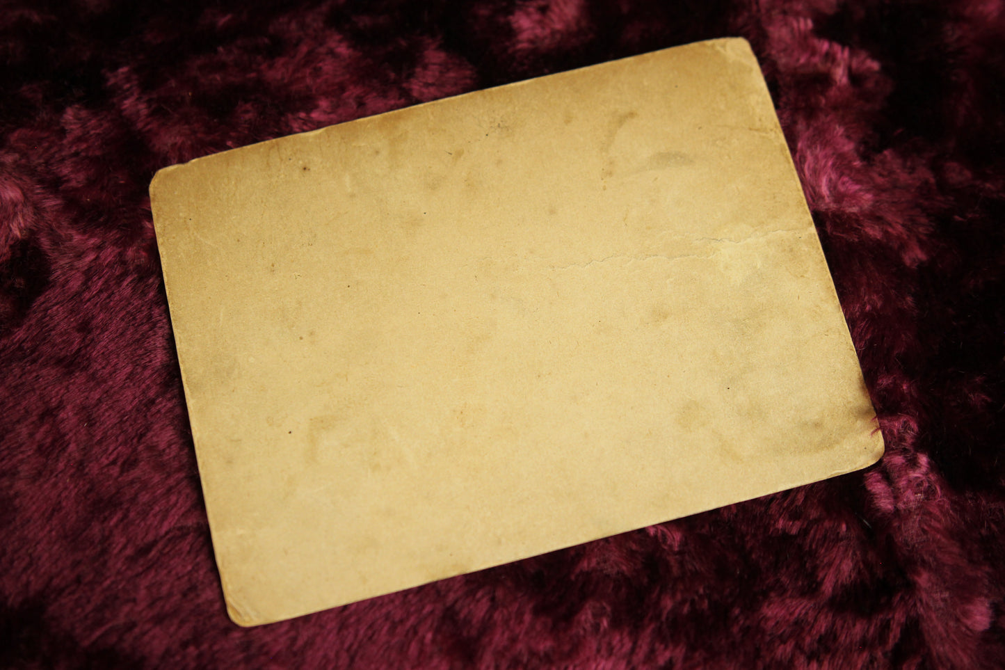 Medical Oddity Cabinet Card Group Photo with Man with Neck Goiter