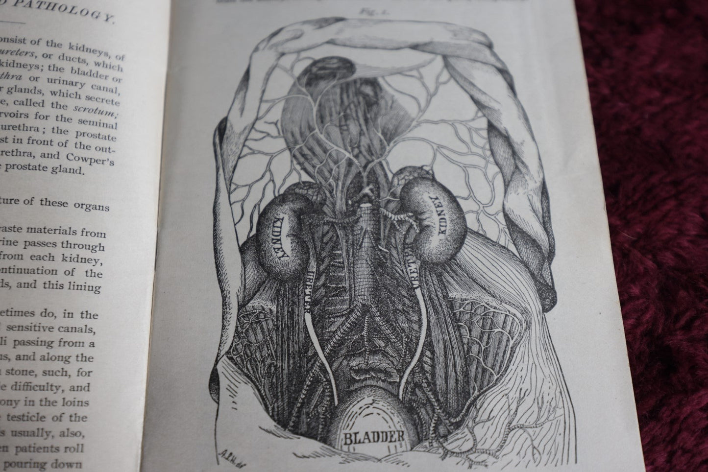 Lot 064 - Antique Pamhlet X, Venereal Disases, Gonorrhea And Syphilis, Including Stricture Of The Urethra, By The World'S Dispensary Medical Association, Buffalo, N.Y.