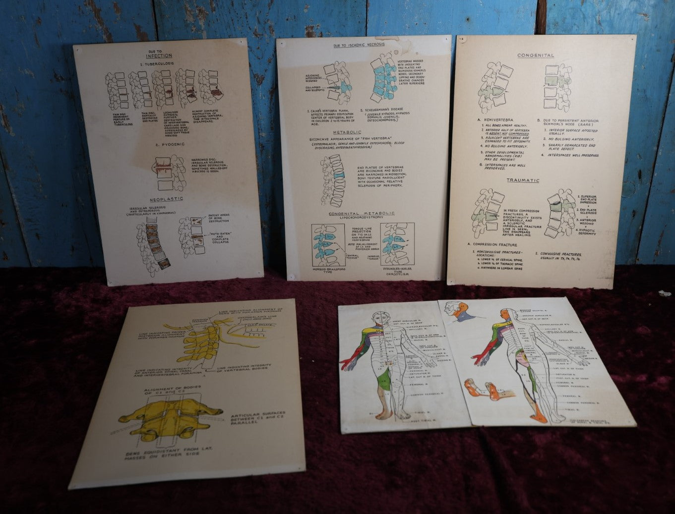 Lot 113 - Five Piece Vintage Medical Poster Lot, Showing Anatomy, Osteology, Spine And More