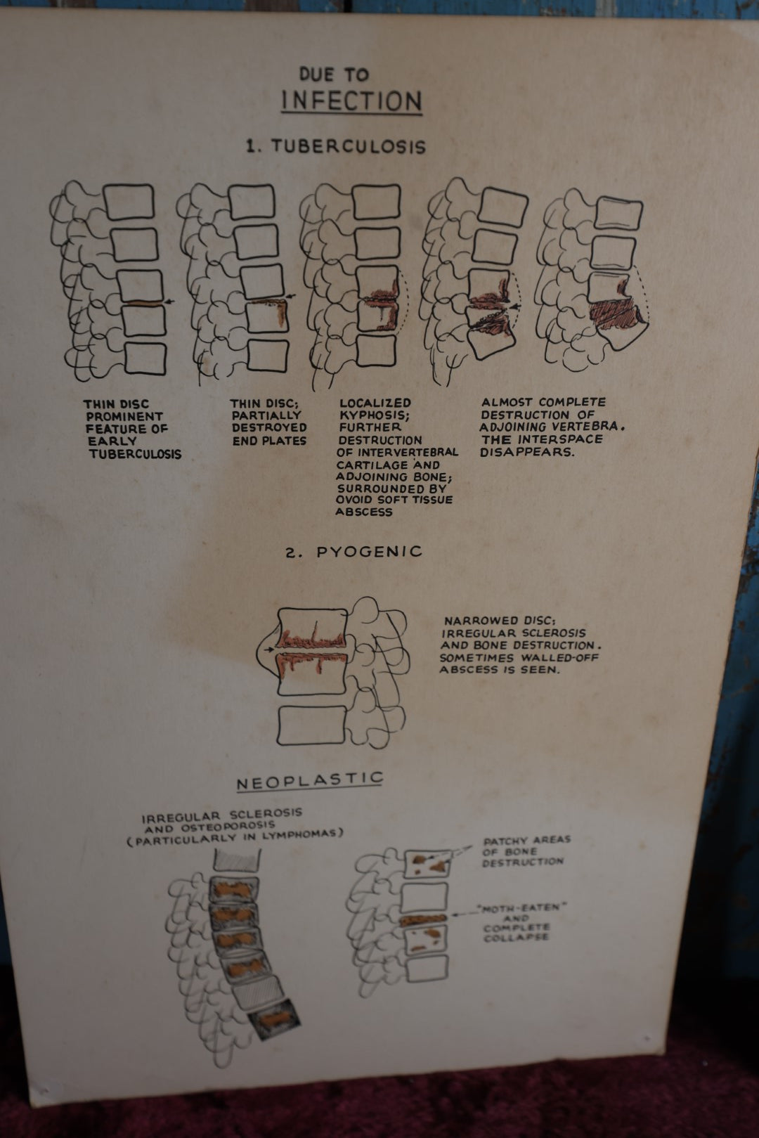 Lot 113 - Five Piece Vintage Medical Poster Lot, Showing Anatomy, Osteology, Spine And More