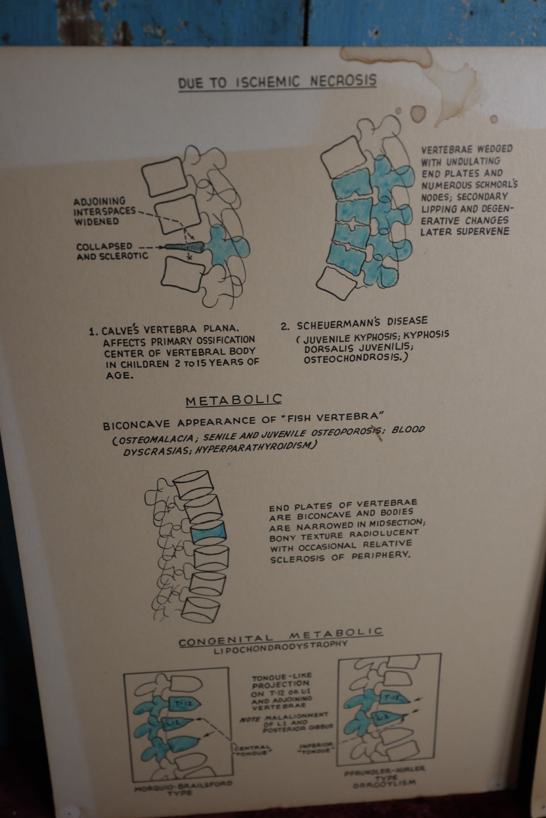 Lot 113 - Five Piece Vintage Medical Poster Lot, Showing Anatomy, Osteology, Spine And More