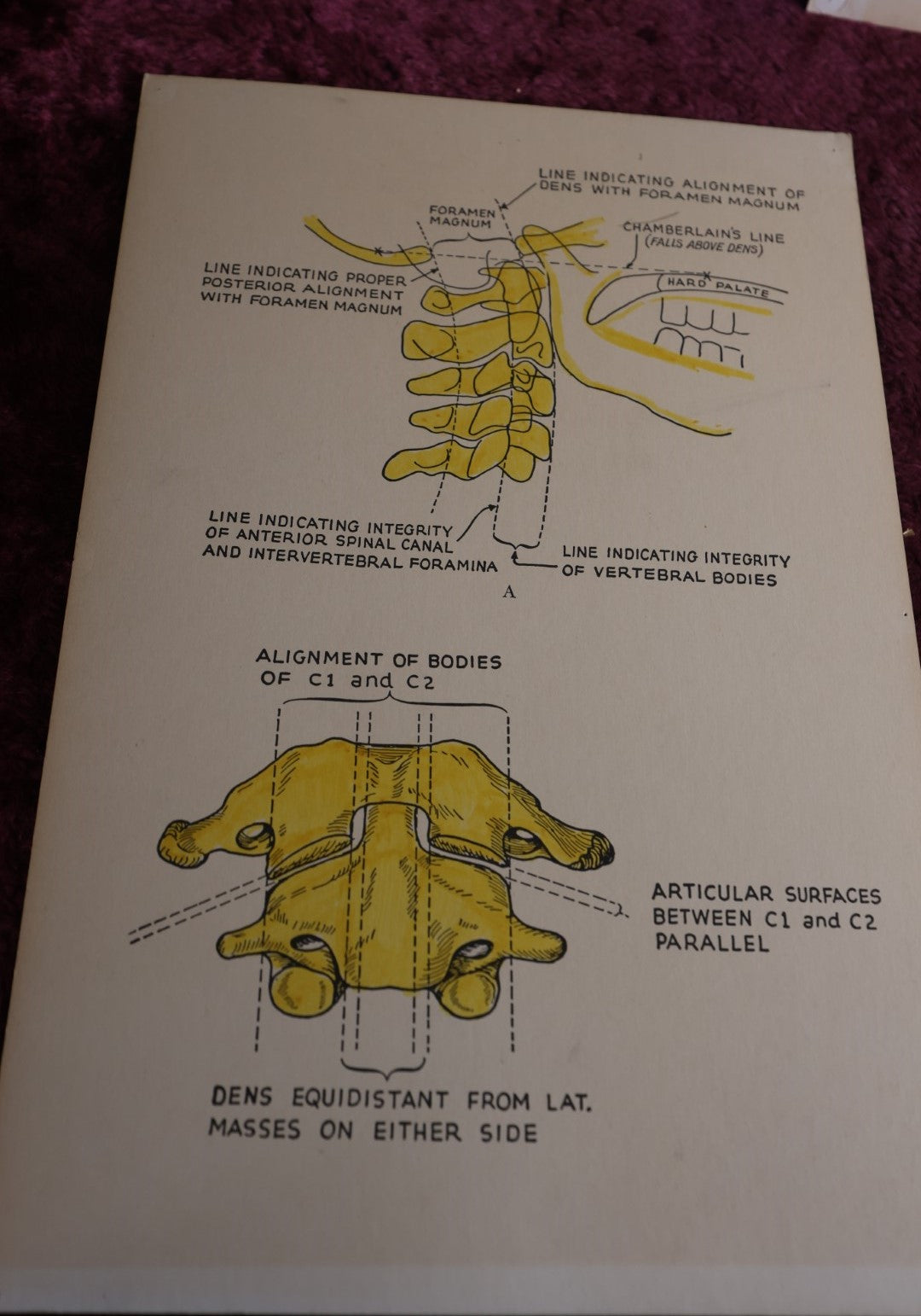 Lot 113 - Five Piece Vintage Medical Poster Lot, Showing Anatomy, Osteology, Spine And More