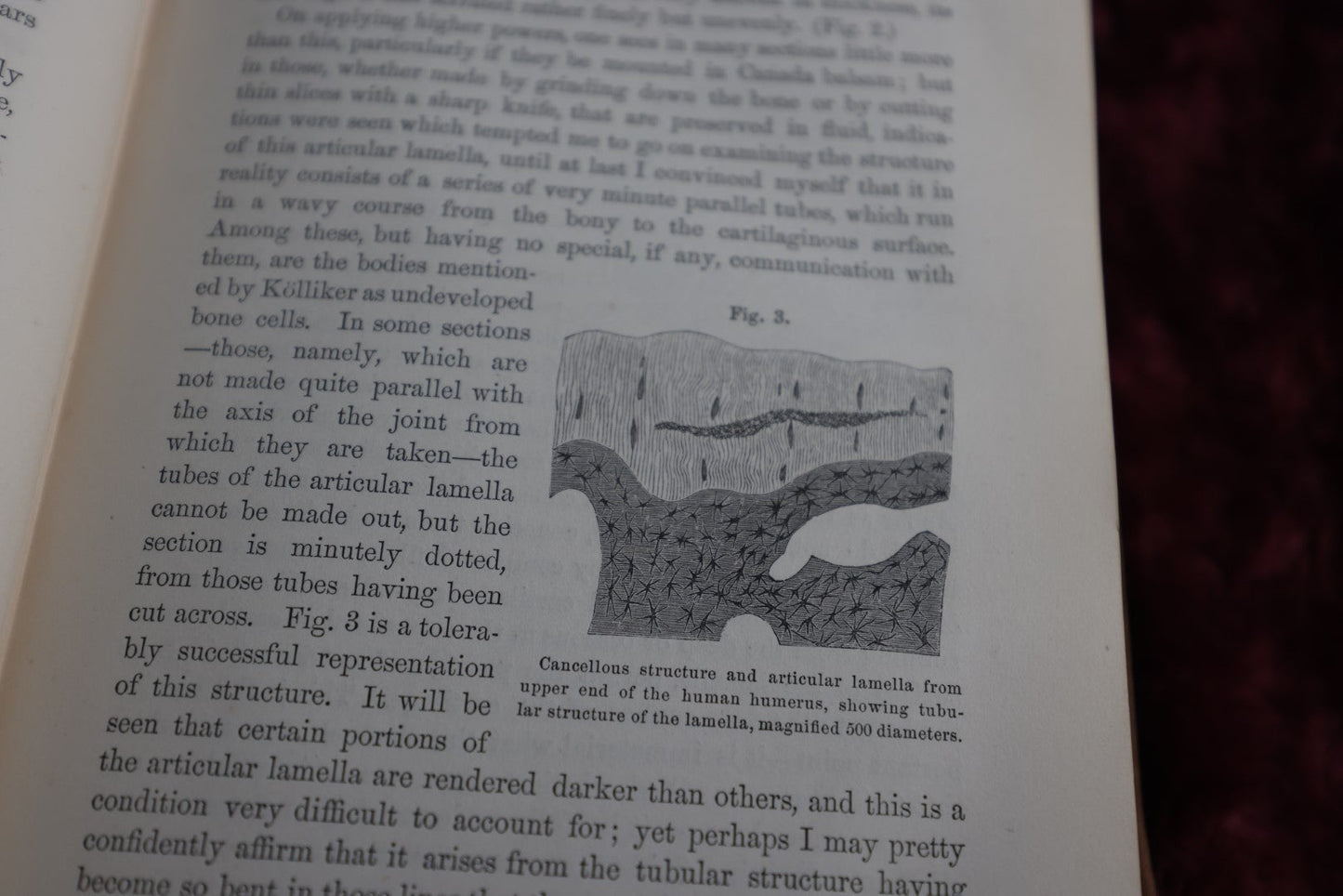 Lot 138 - Antique Medical Book, A Treatise On The Diseases Of The Joints, By Richard Barwell, Surgeon, 1861, Illustrated