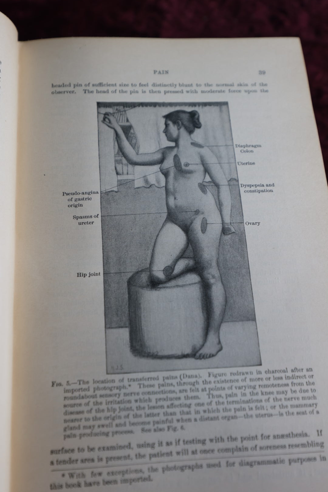 Lot 143 - Antique Medical Book, Diagnostics Of Internal Medicine, By Glenworth Reeve Buttler, M.D., 1905, Illustrated