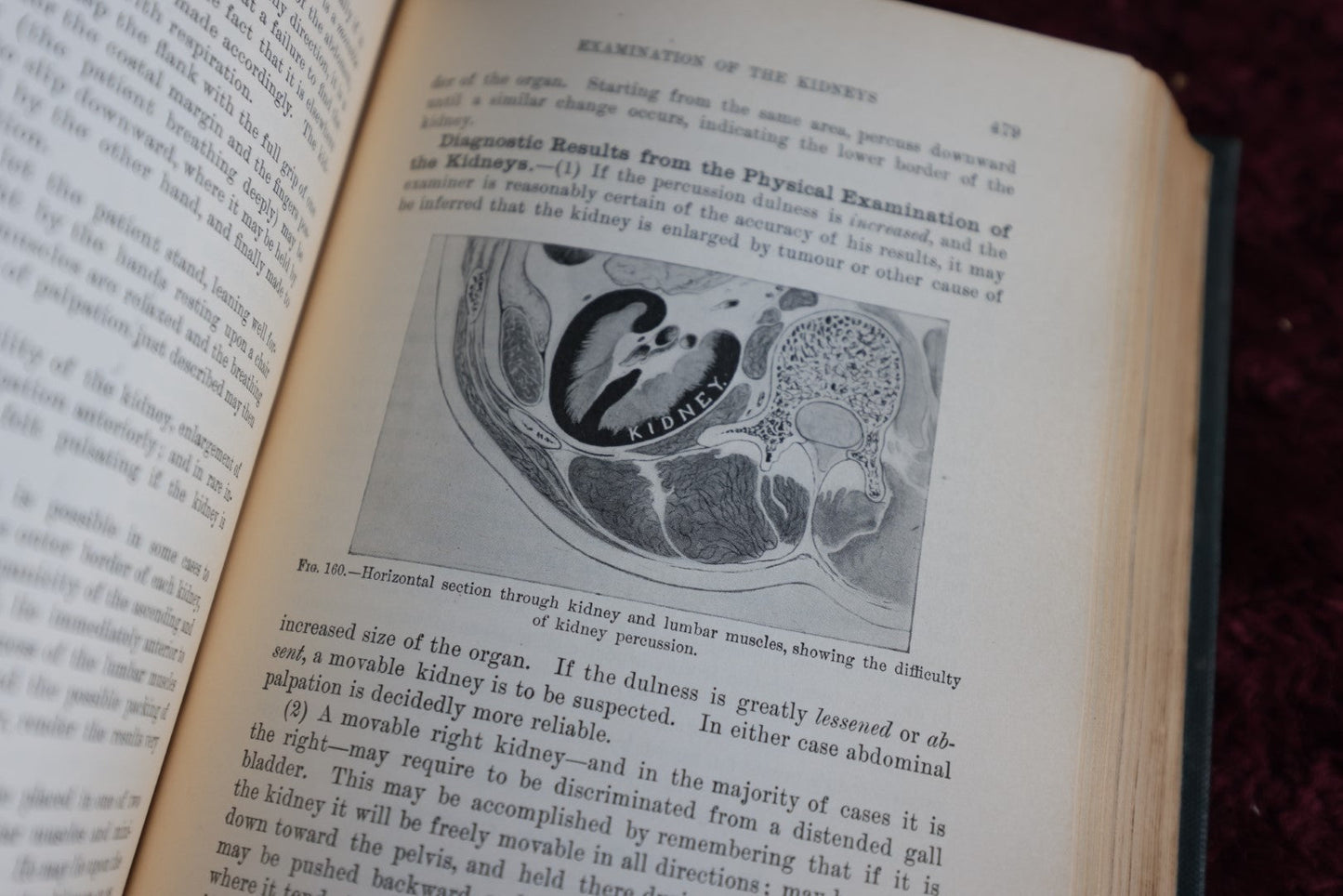 Lot 143 - Antique Medical Book, Diagnostics Of Internal Medicine, By Glenworth Reeve Buttler, M.D., 1905, Illustrated