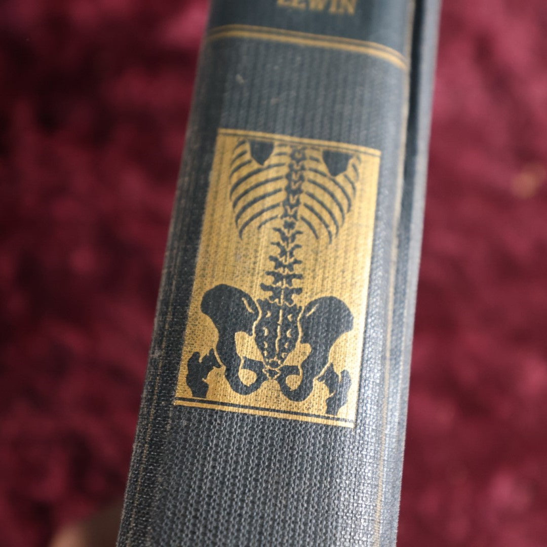 Lot 144 - Backache And Sciatic Neuritis Vintage Medical Book By Philip Lewin, M.D., Spine And Bones On Spine Of Book, 1944 Reprint