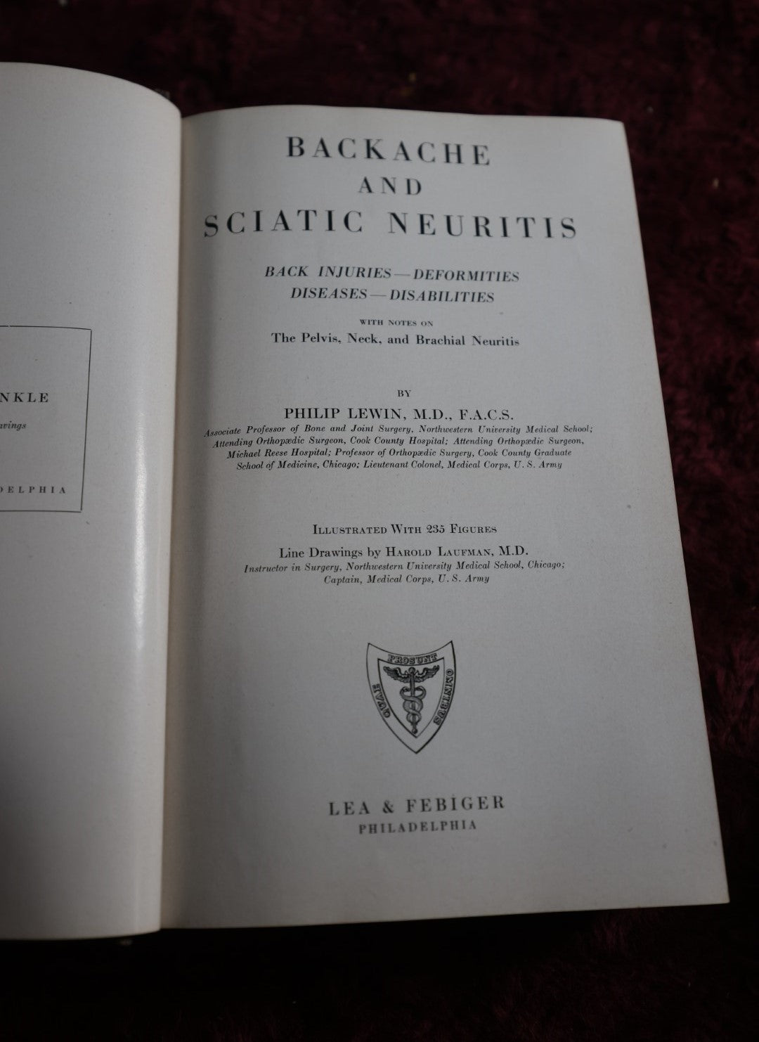 Lot 144 - Backache And Sciatic Neuritis Vintage Medical Book By Philip Lewin, M.D., Spine And Bones On Spine Of Book, 1944 Reprint