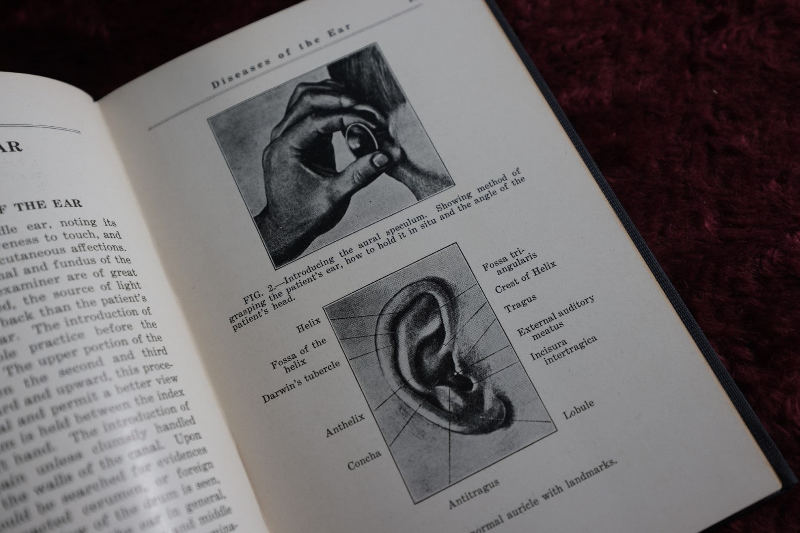 Lot 147 - Orificial Surgery Antique Medical Book, By J. Douglas Thomspon, First Edition, 1924, Illustrated