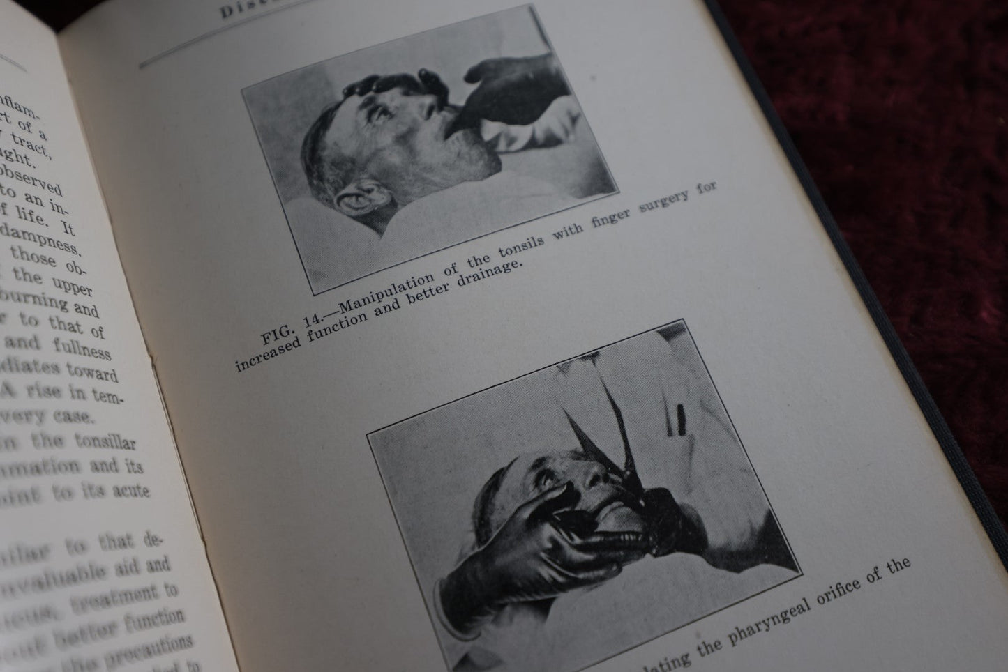 Lot 147 - Orificial Surgery Antique Medical Book, By J. Douglas Thomspon, First Edition, 1924, Illustrated