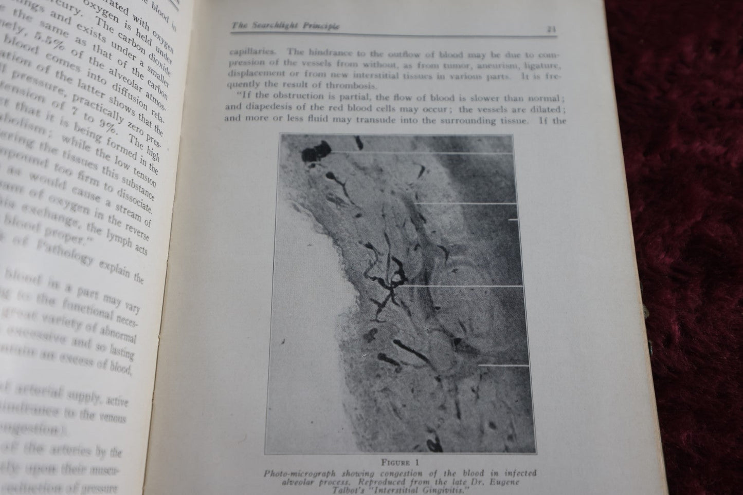 Lot 148 - Diagnosis By Transillumination Antique Medical Book, By W.J. Cameron, 1927, Illustrated, Plus Related Pamphlet