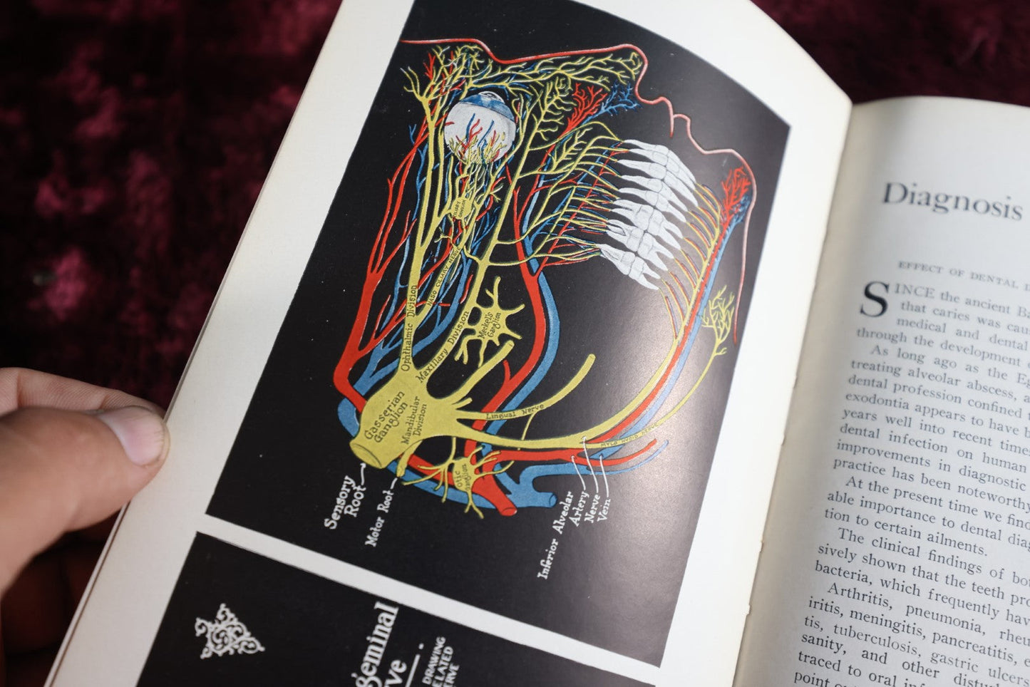 Lot 148 - Diagnosis By Transillumination Antique Medical Book, By W.J. Cameron, 1927, Illustrated, Plus Related Pamphlet