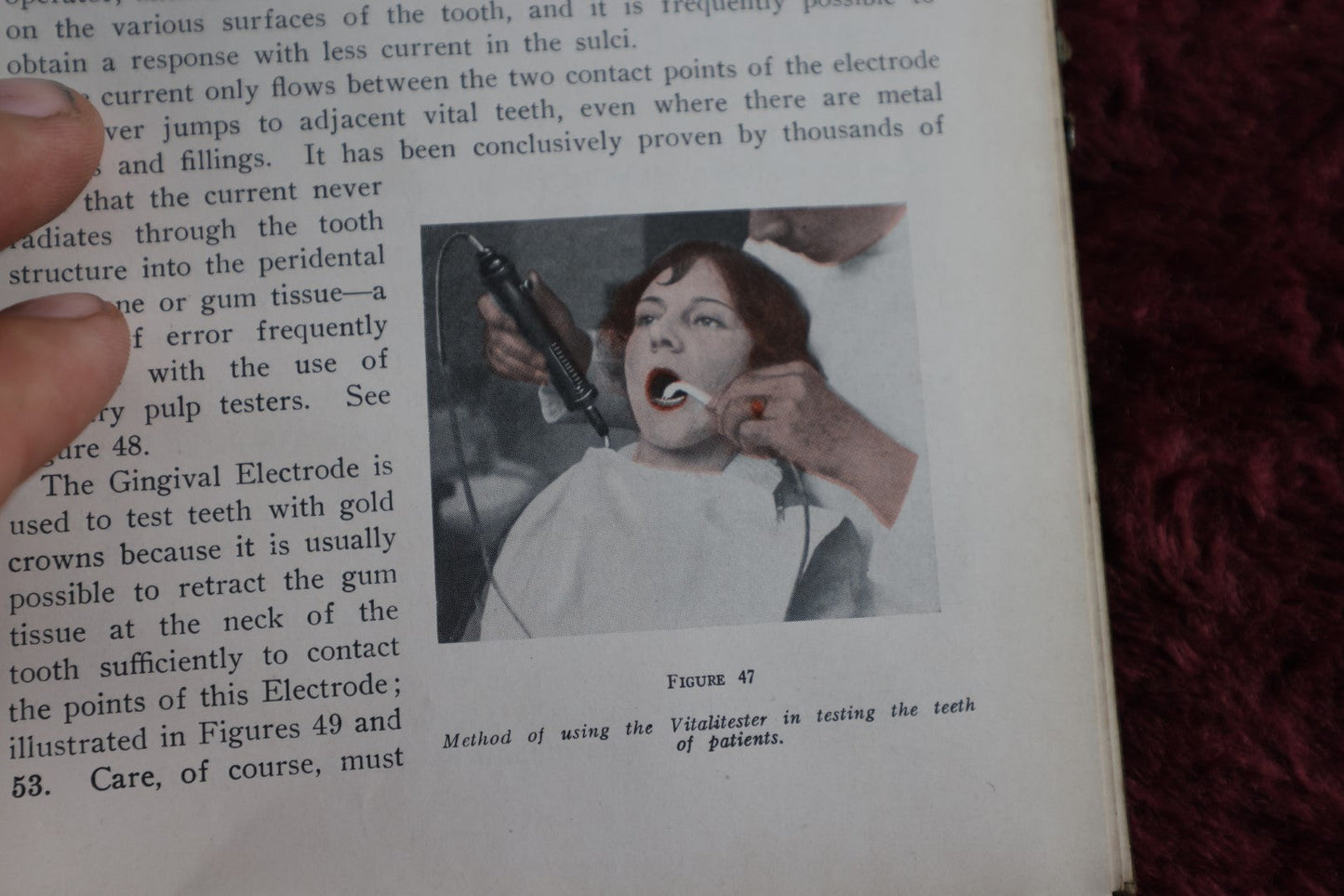 Lot 148 - Diagnosis By Transillumination Antique Medical Book, By W.J. Cameron, 1927, Illustrated, Plus Related Pamphlet