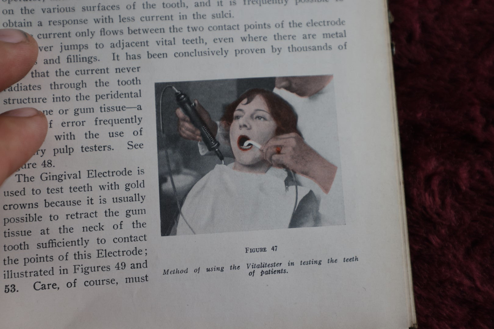 Lot 148 - Diagnosis By Transillumination Antique Medical Book, By W.J. Cameron, 1927, Illustrated, Plus Related Pamphlet