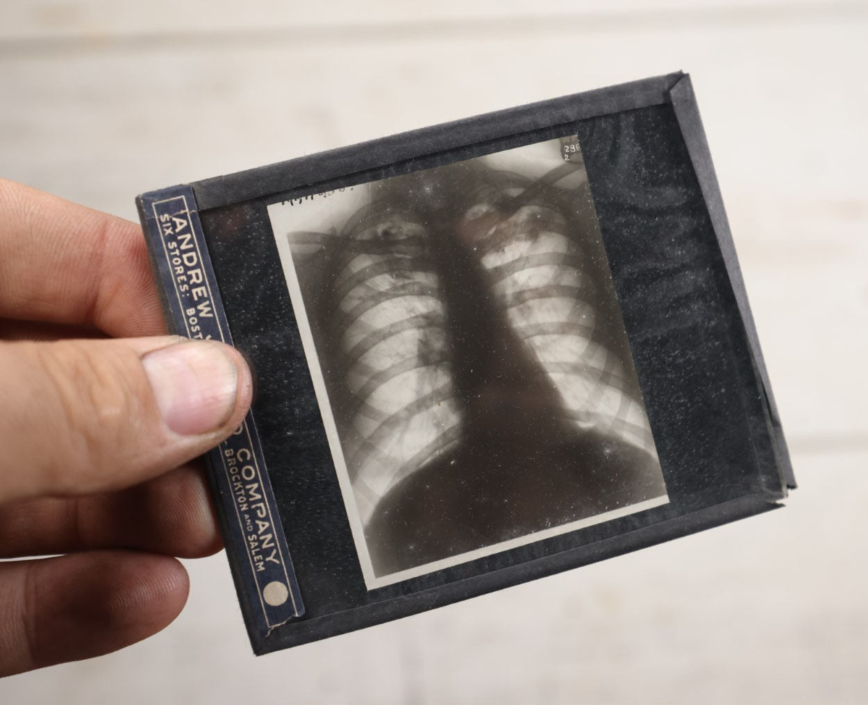 Lot 039 - Grouping Of Twelve Antique Magic Lantern Slide X-Rays Of The Ribs, Chest, And Torso