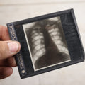 Lot 039 - Grouping Of Twelve Antique Magic Lantern Slide X-Rays Of The Ribs, Chest, And Torso