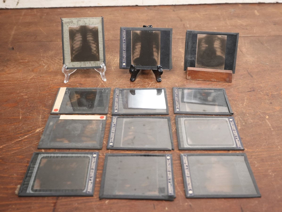 Lot 039 - Grouping Of Twelve Antique Magic Lantern Slide X-Rays Of The Ribs, Chest, And Torso