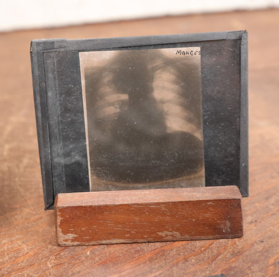 Lot 039 - Grouping Of Twelve Antique Magic Lantern Slide X-Rays Of The Ribs, Chest, And Torso