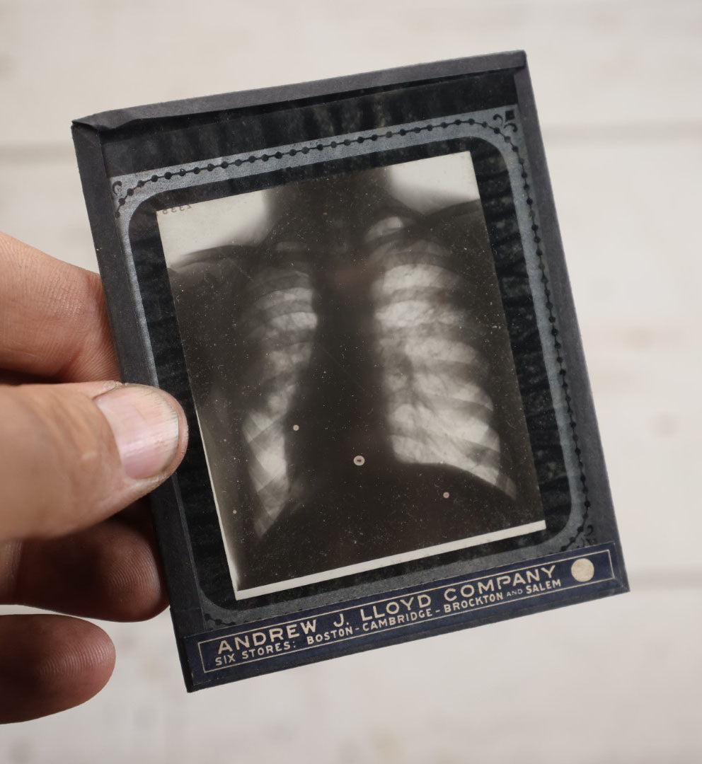 Lot 039 - Grouping Of Twelve Antique Magic Lantern Slide X-Rays Of The Ribs, Chest, And Torso