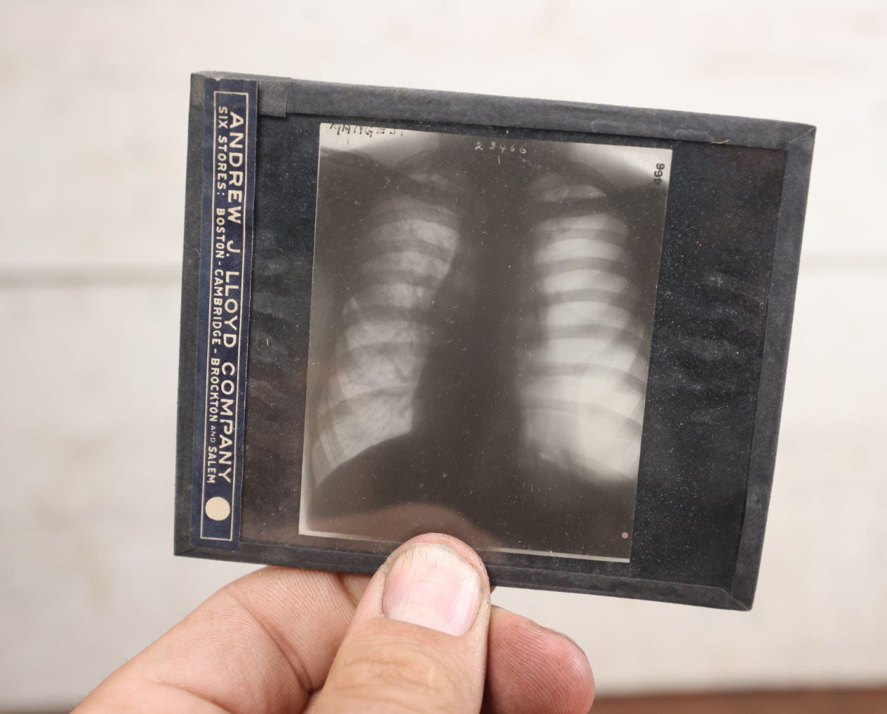 Lot 039 - Grouping Of Twelve Antique Magic Lantern Slide X-Rays Of The Ribs, Chest, And Torso