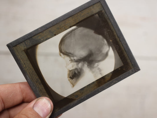 Lot 040 - Grouping Of Ten Antique Magic Lantern Slide X-Rays Of The Head And Skull