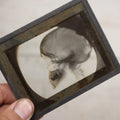 Lot 040 - Grouping Of Ten Antique Magic Lantern Slide X-Rays Of The Head And Skull