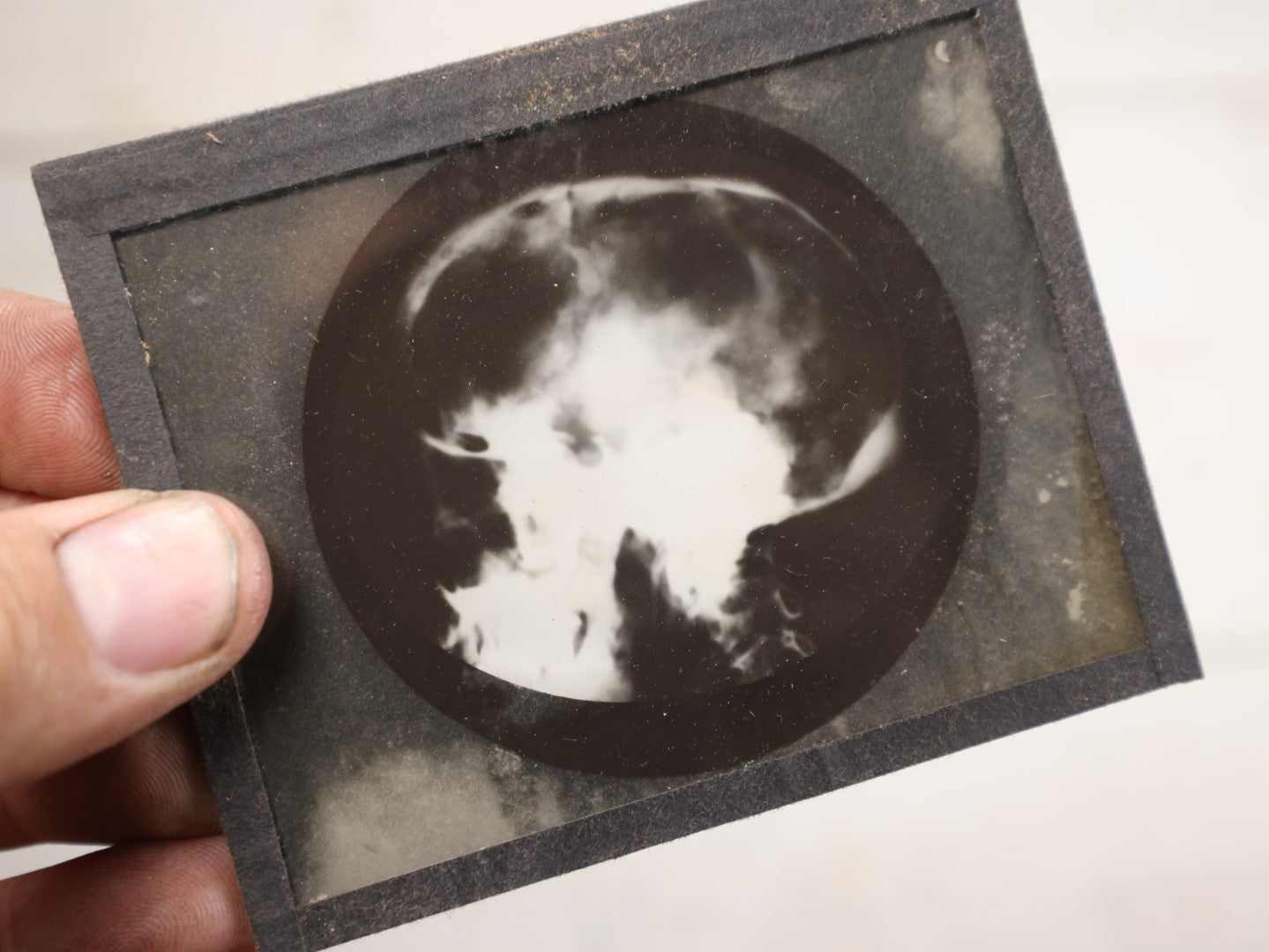 Lot 041 - Boxed Grouping Of Five Antique Magic Lantern Slide X-Rays Of The "Sciuto Case," Per Note On Box, Likely Showing Pathology