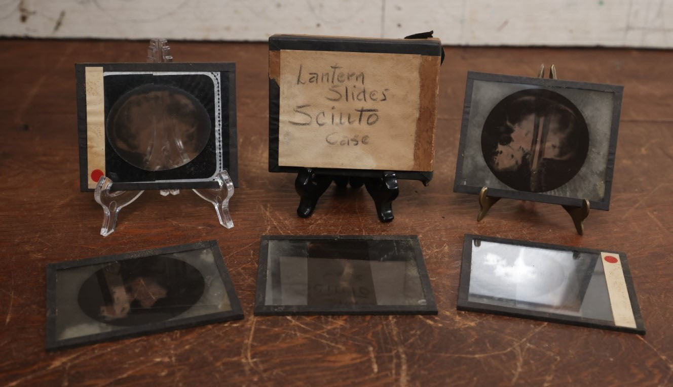 Lot 041 - Boxed Grouping Of Five Antique Magic Lantern Slide X-Rays Of The "Sciuto Case," Per Note On Box, Likely Showing Pathology