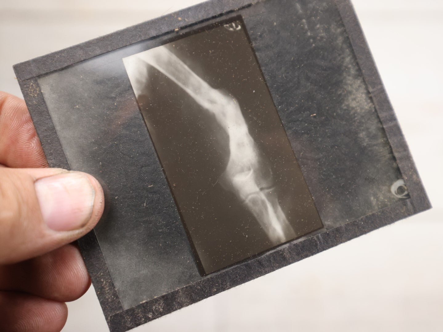 Lot 041 - Boxed Grouping Of Five Antique Magic Lantern Slide X-Rays Of The "Sciuto Case," Per Note On Box, Likely Showing Pathology