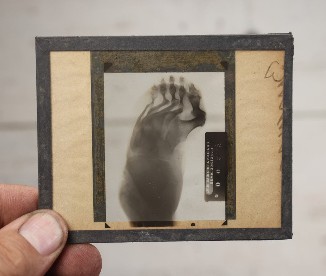 Lot 043 - Single Antique Magic Lantern Slide X-Ray Of Deformed Foot, By Charles J. Burgess, M.D.