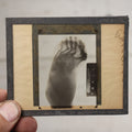Lot 043 - Single Antique Magic Lantern Slide X-Ray Of Deformed Foot, By Charles J. Burgess, M.D.