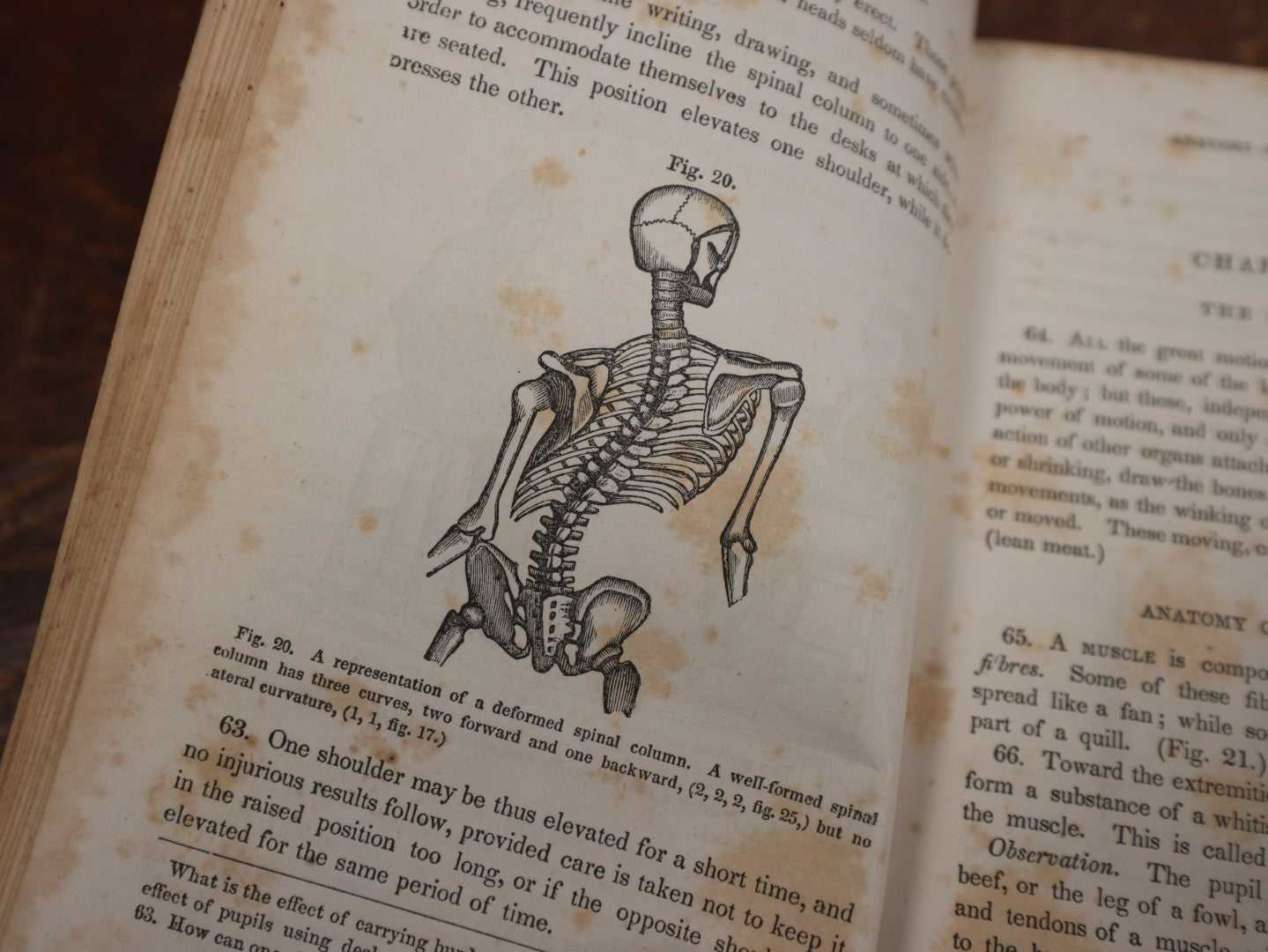 Lot 124 - "First Book Of Anatomy, Physiology, And Hygiene" Antique Book By Calvin Cutter, M.D., With Eighty-Three Engravings, Published 1956