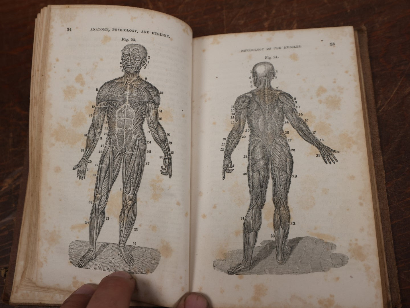 Lot 124 - "First Book Of Anatomy, Physiology, And Hygiene" Antique Book By Calvin Cutter, M.D., With Eighty-Three Engravings, Published 1956