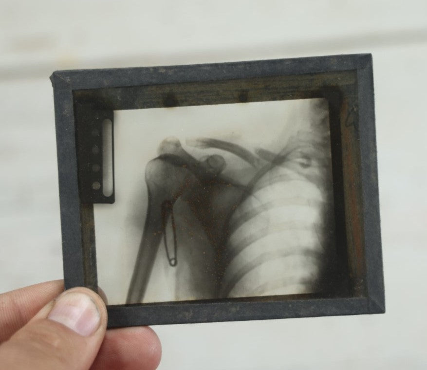 Lot 042 - Grouping Of Nineteen Antique Magic Lantern Slide X-Rays Of The Pelvis, Ribs, Chest, Shoulders, Torso