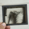 Lot 042 - Grouping Of Nineteen Antique Magic Lantern Slide X-Rays Of The Pelvis, Ribs, Chest, Shoulders, Torso
