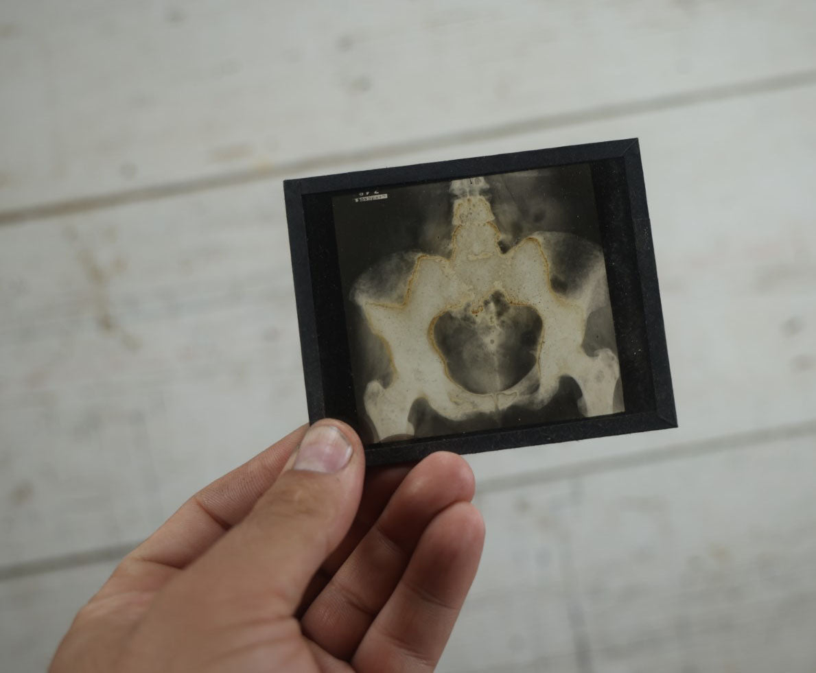 Lot 042 - Grouping Of Nineteen Antique Magic Lantern Slide X-Rays Of The Pelvis, Ribs, Chest, Shoulders, Torso