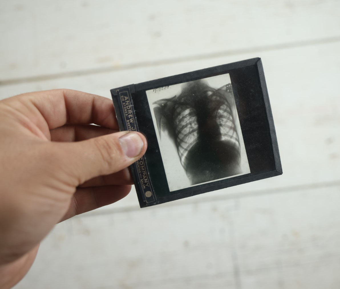 Lot 042 - Grouping Of Nineteen Antique Magic Lantern Slide X-Rays Of The Pelvis, Ribs, Chest, Shoulders, Torso