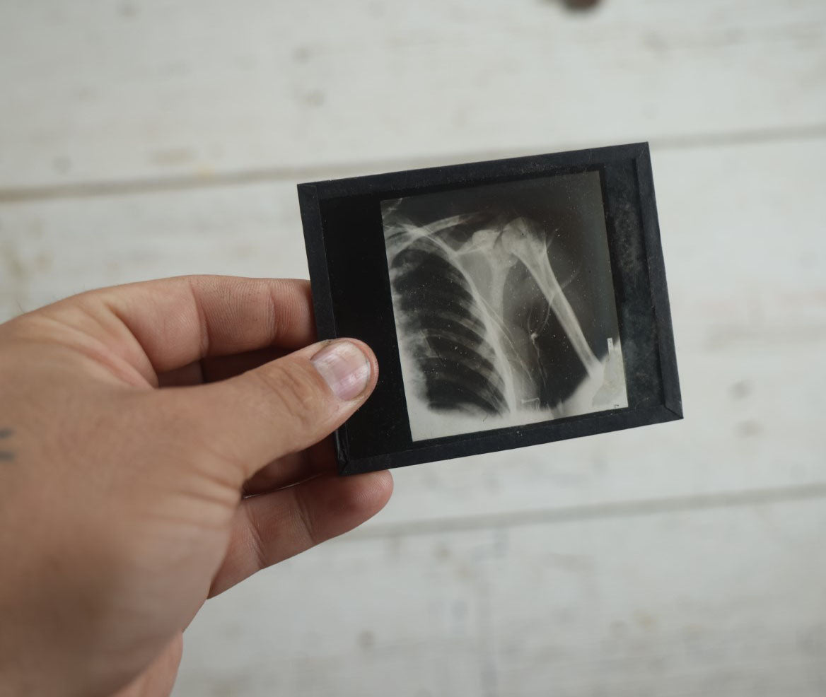 Lot 042 - Grouping Of Nineteen Antique Magic Lantern Slide X-Rays Of The Pelvis, Ribs, Chest, Shoulders, Torso