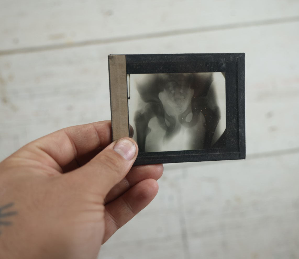 Lot 042 - Grouping Of Nineteen Antique Magic Lantern Slide X-Rays Of The Pelvis, Ribs, Chest, Shoulders, Torso