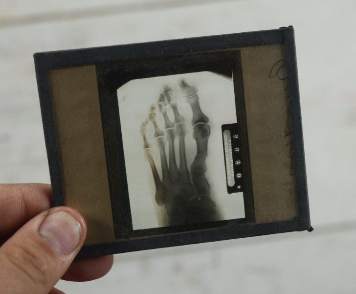 Lot 043 - Grouping Of Fourteen Antique Magic Lantern Slide X-Rays Of The Hands, Feet, Head, And Teeth