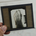Lot 043 - Grouping Of Fourteen Antique Magic Lantern Slide X-Rays Of The Hands, Feet, Head, And Teeth