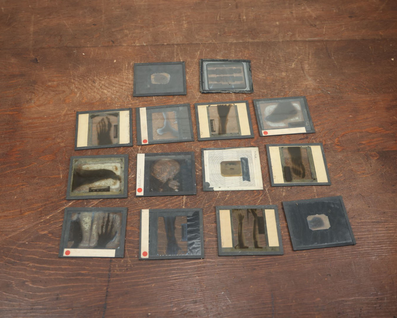 Lot 043 - Grouping Of Fourteen Antique Magic Lantern Slide X-Rays Of The Hands, Feet, Head, And Teeth