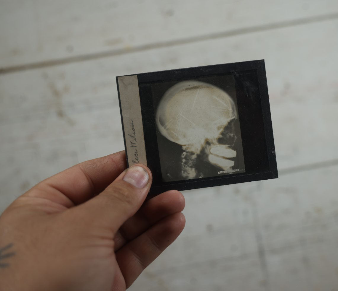 Lot 043 - Grouping Of Fourteen Antique Magic Lantern Slide X-Rays Of The Hands, Feet, Head, And Teeth