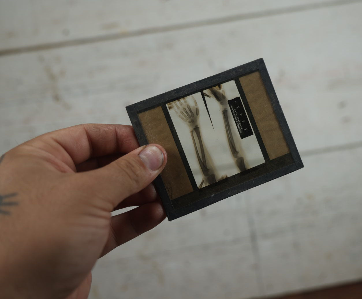 Lot 043 - Grouping Of Fourteen Antique Magic Lantern Slide X-Rays Of The Hands, Feet, Head, And Teeth