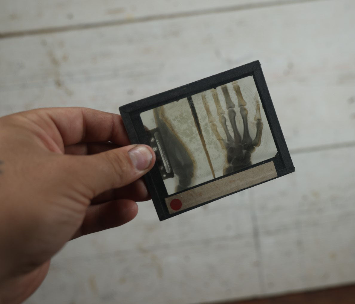 Lot 043 - Grouping Of Fourteen Antique Magic Lantern Slide X-Rays Of The Hands, Feet, Head, And Teeth