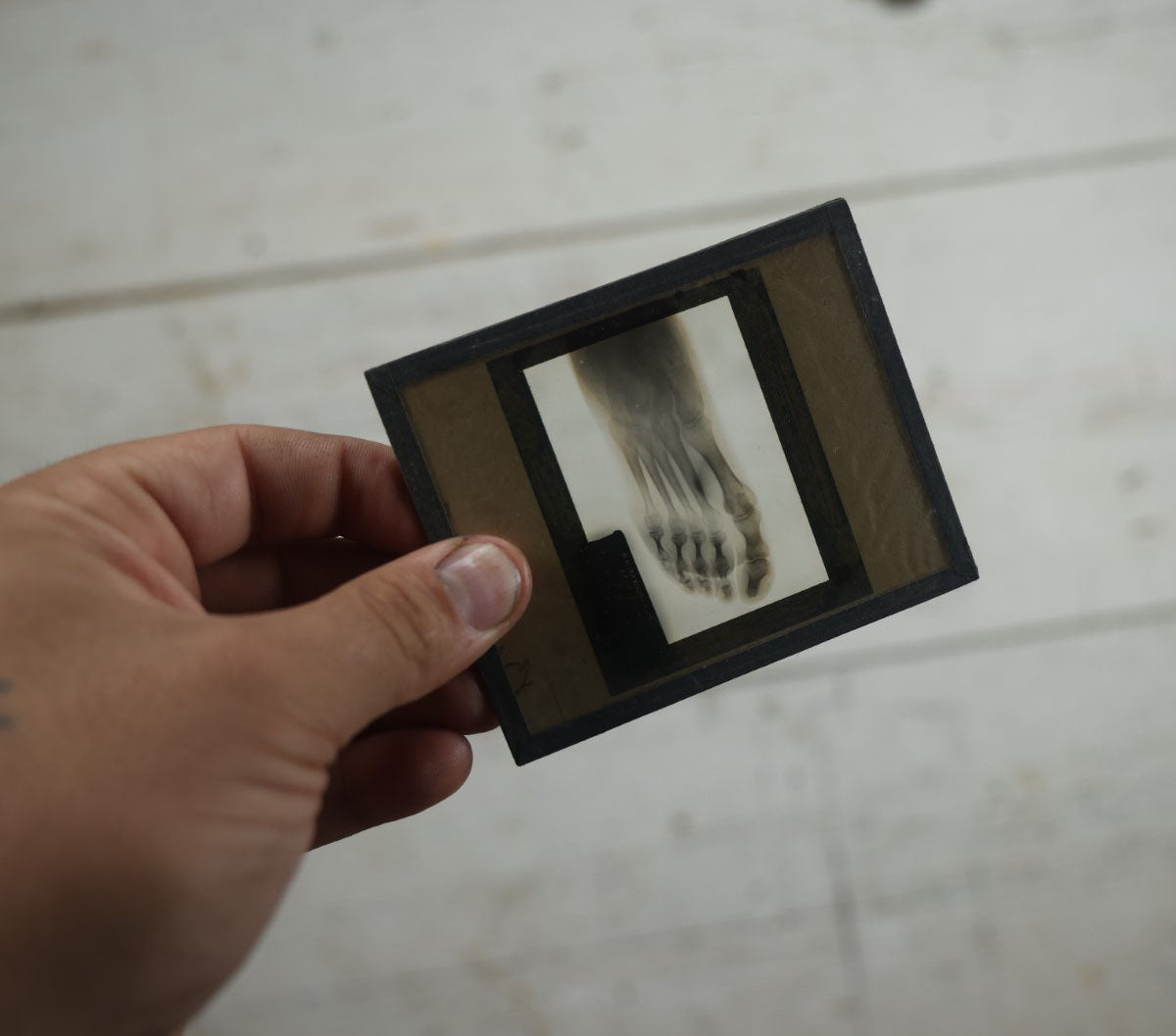 Lot 043 - Grouping Of Fourteen Antique Magic Lantern Slide X-Rays Of The Hands, Feet, Head, And Teeth