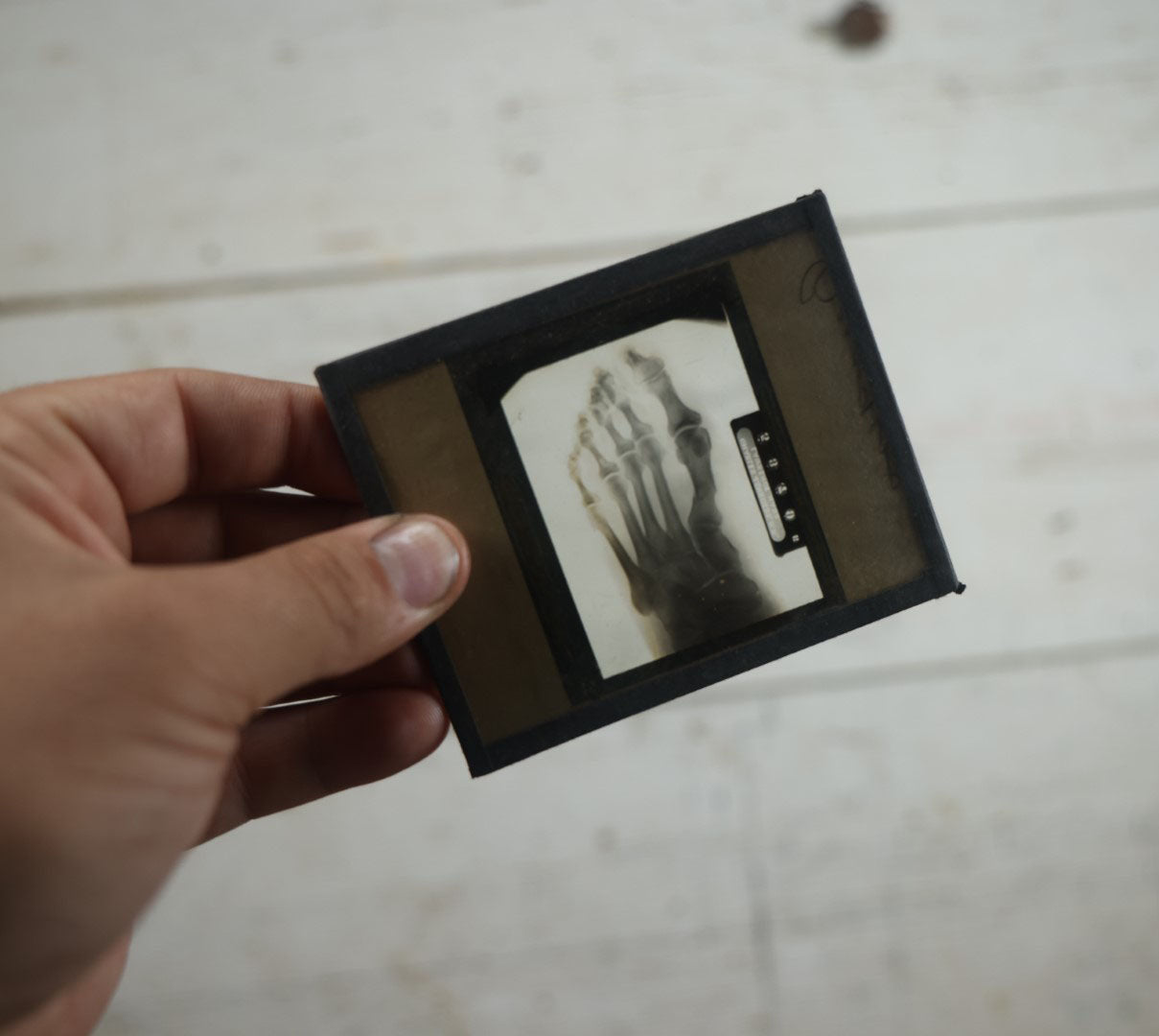 Lot 043 - Grouping Of Fourteen Antique Magic Lantern Slide X-Rays Of The Hands, Feet, Head, And Teeth