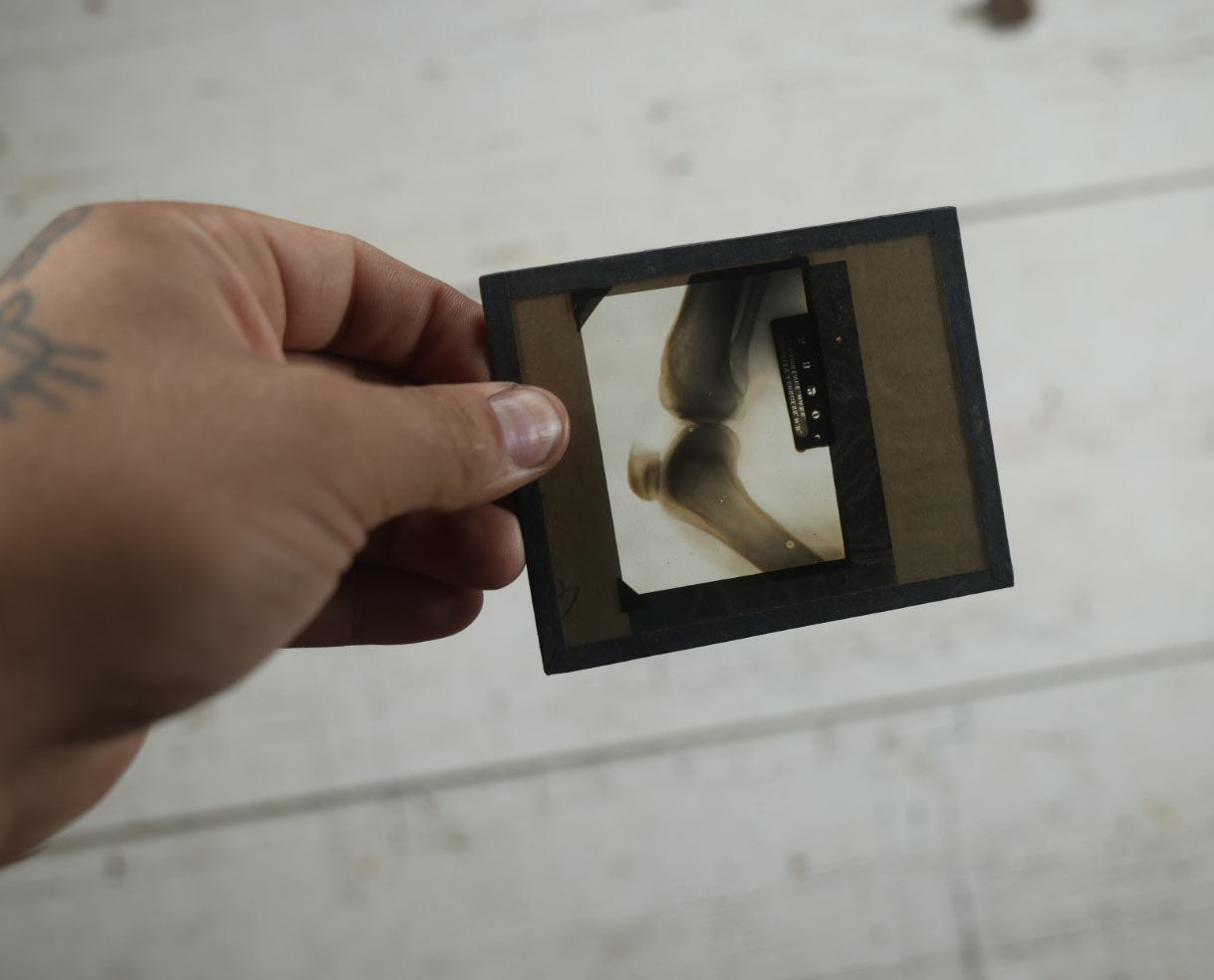 Lot 044 - Grouping Of Seventeen Antique Magic Lantern Slide X-Rays Of The Joints, Arms, Legs