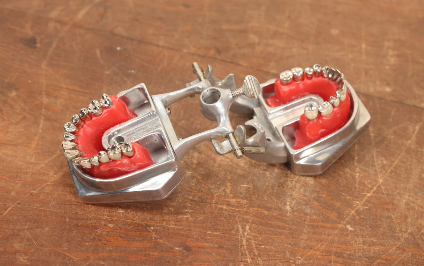 Lot 017 - Vintage Dental Mold Model, Wax And Plastic With Metal Frame, Metal Caps On Teeth