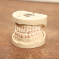 Lot 018 - Vintage Resin Teeth Mold Model, With Screws And Metal Plates